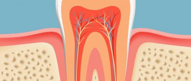 Root canal treatment or dental implants?