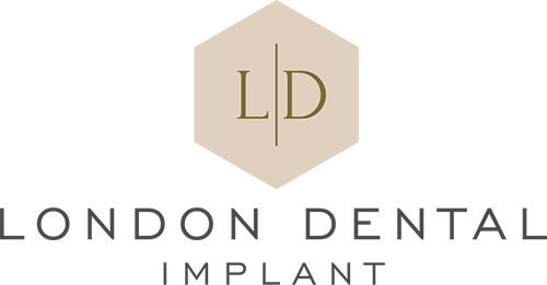 Invisalign at Battersea Dentist, London Dental Implant