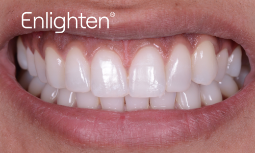 Case 2 After