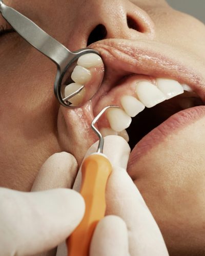 emergency-dental-treatment.jpeg
